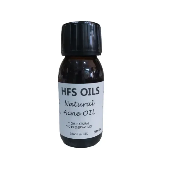 Natural Acne Oil